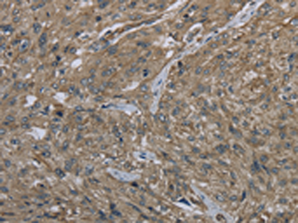 Rabbit Polyclonal Antibody to CLPS