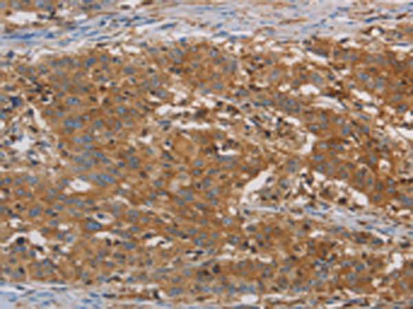 Rabbit Polyclonal Antibody to CFL1