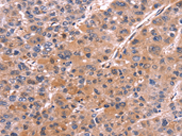 Rabbit Polyclonal Antibody to COL20A1