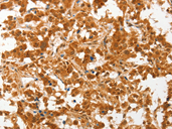 Rabbit Polyclonal Antibody to CERT1