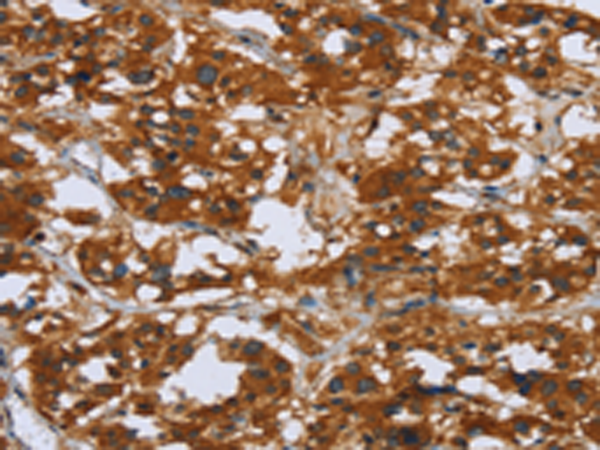 Rabbit Polyclonal Antibody to COMP