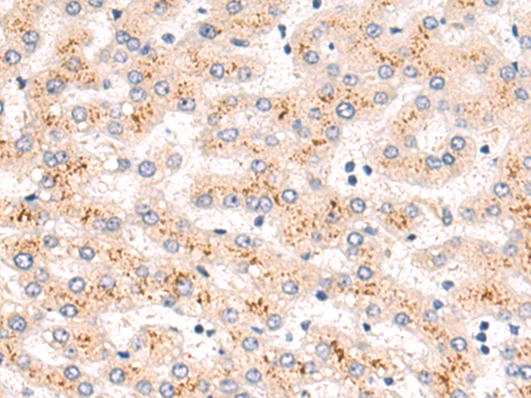 Rabbit Polyclonal Antibody to CORIN