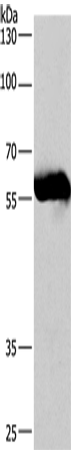 Rabbit Polyclonal Antibody to CORO1C