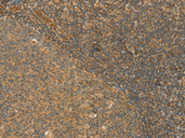 Rabbit Polyclonal Antibody to CPA2