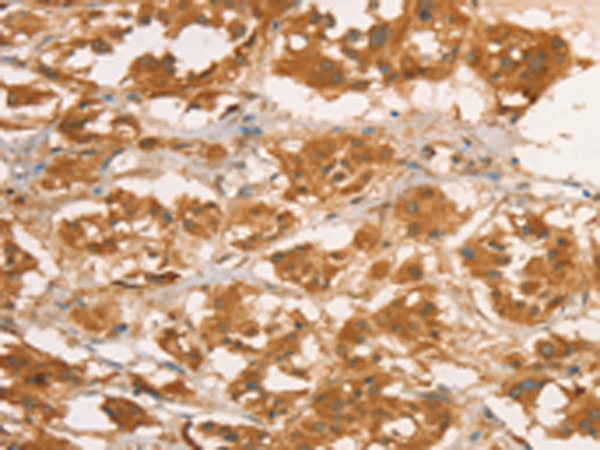 Rabbit Polyclonal Antibody to CPB1