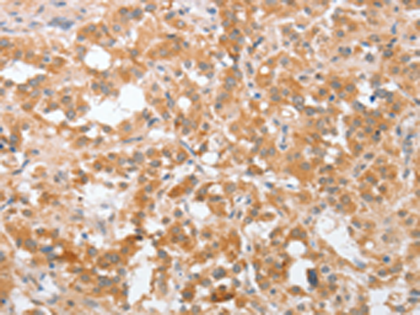 Rabbit Polyclonal Antibody to PLA2G4A