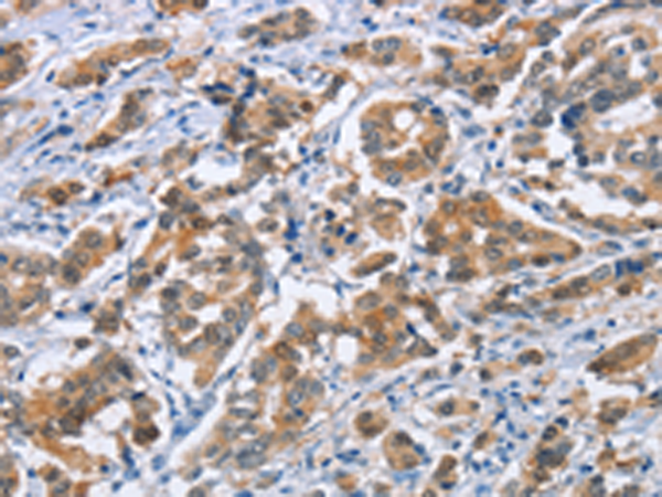 Rabbit Polyclonal Antibody to CRABP2