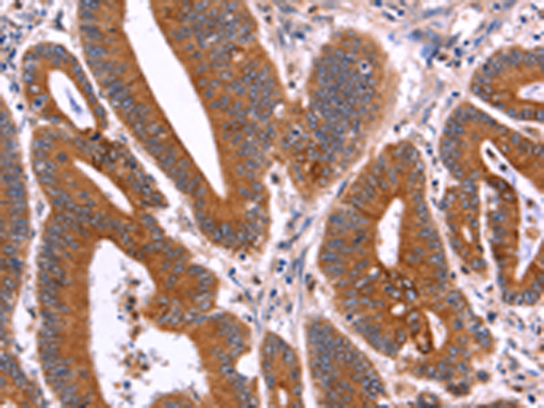 Rabbit Polyclonal Antibody to CRISP3