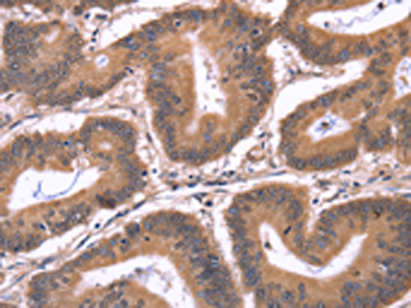 Rabbit Polyclonal Antibody to CRK