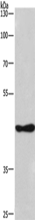 Rabbit Polyclonal Antibody to CSNK1D