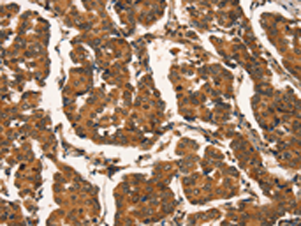 Rabbit Polyclonal Antibody to CTNNBIP1