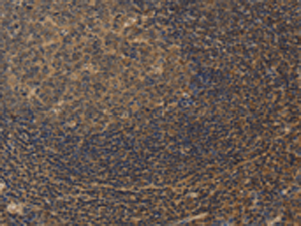Rabbit Polyclonal Antibody to CXXC5