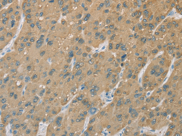 Rabbit Polyclonal Antibody to CYP2C9