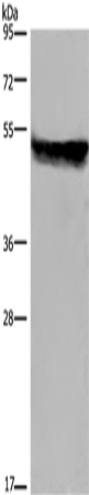Rabbit Polyclonal Antibody to CYP2E1