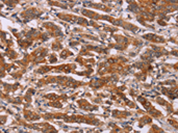Rabbit Polyclonal Antibody to CYP2W1