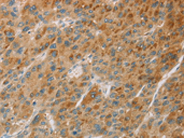 Rabbit Polyclonal Antibody to CYP11B1