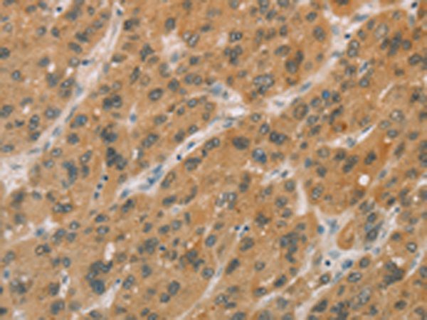 Rabbit Polyclonal Antibody to CYP11A1