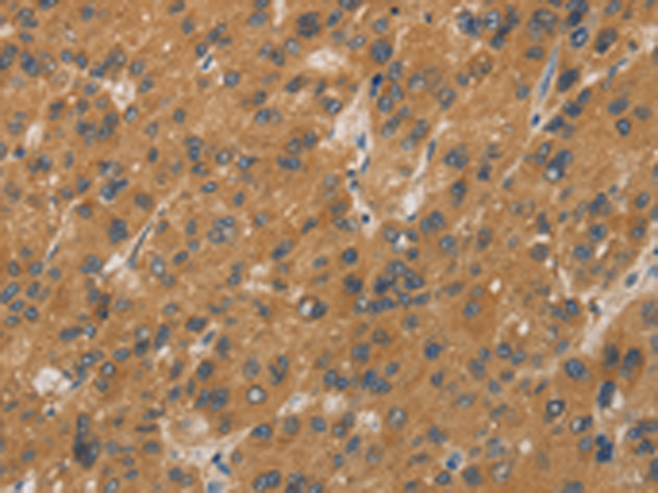 Rabbit Polyclonal Antibody to CYP17A1