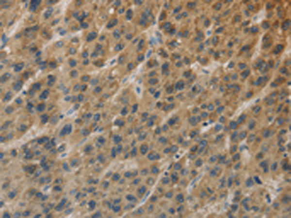 Rabbit Polyclonal Antibody to TBXAS1