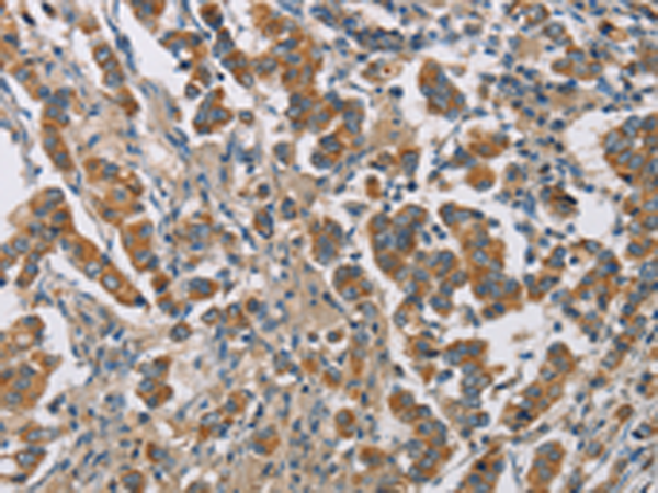 Rabbit Polyclonal Antibody to CYP4A11