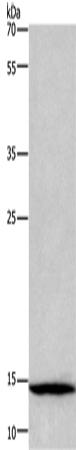 Rabbit Polyclonal Antibody to CSTA