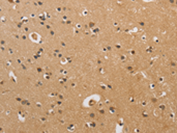 Rabbit Polyclonal Antibody to CST6