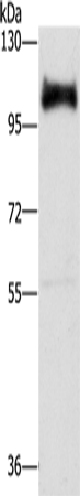 Rabbit Polyclonal Antibody to DAB2