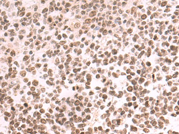 Rabbit Polyclonal Antibody to DACH1