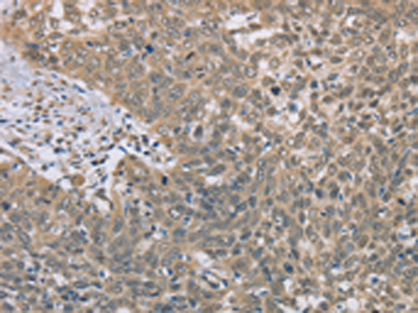 Rabbit Polyclonal Antibody to DACH2