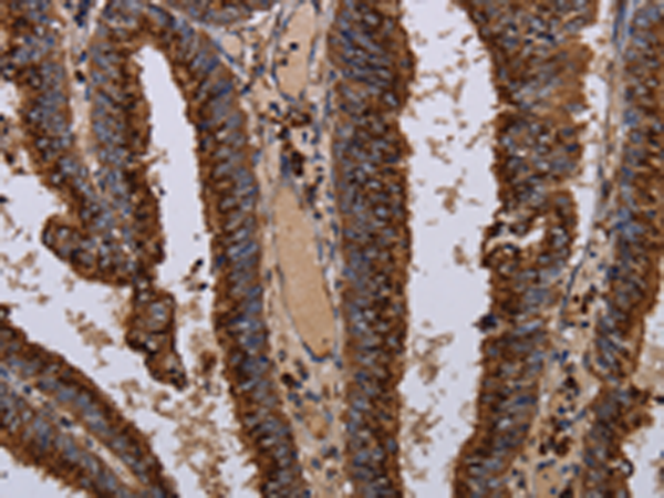 Rabbit Polyclonal Antibody to PPP1R1B