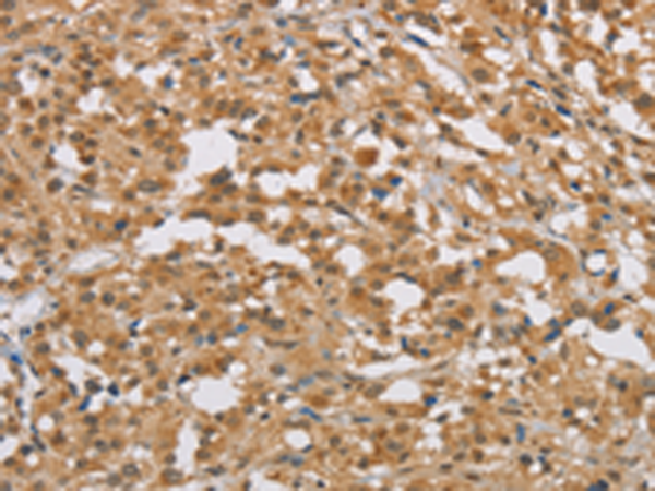 Rabbit Polyclonal Antibody to DIDO1