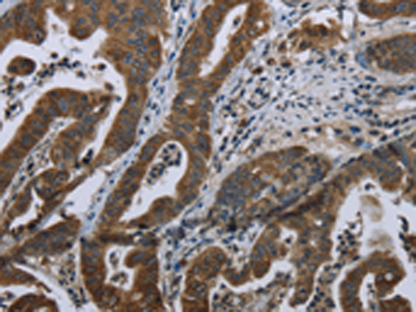 Rabbit Polyclonal Antibody to BRINP1