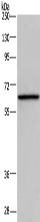 Rabbit Polyclonal Antibody to DBH