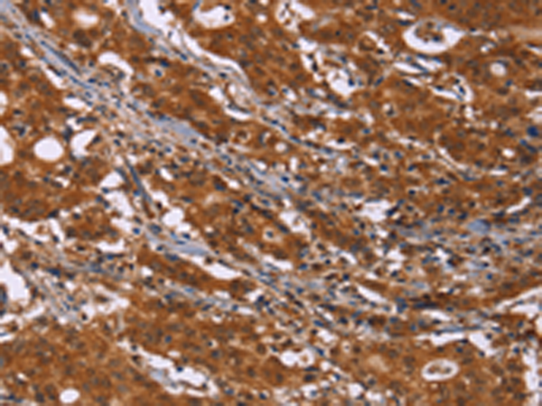 Rabbit Polyclonal Antibody to DCBLD2