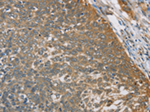 Rabbit Polyclonal Antibody to TNFRSF10D