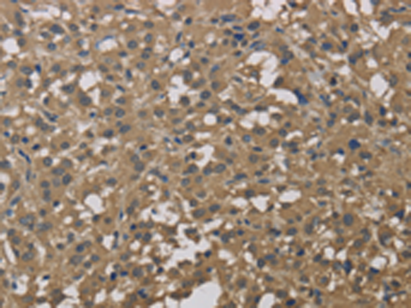 Rabbit Polyclonal Antibody to DCTN3