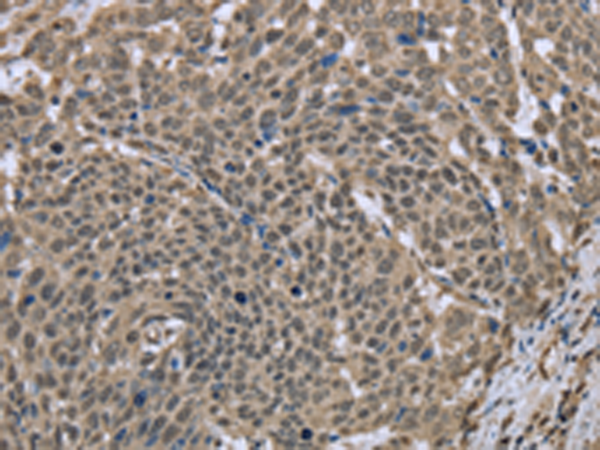 Rabbit Polyclonal Antibody to DCTN4