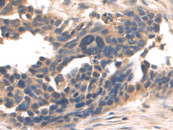 Rabbit Polyclonal Antibody to DCTN5