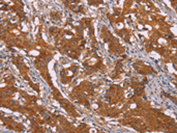 Rabbit Polyclonal Antibody to DCTN6