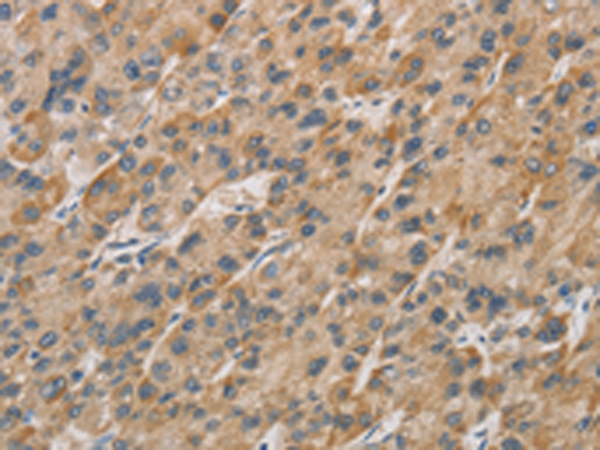 Rabbit Polyclonal Antibody to DDIT4L