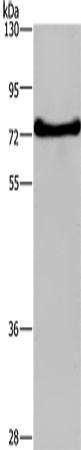 Rabbit Polyclonal Antibody to DDX43