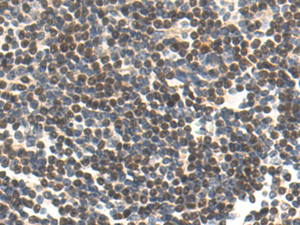 Rabbit Polyclonal Antibody to DEDD2