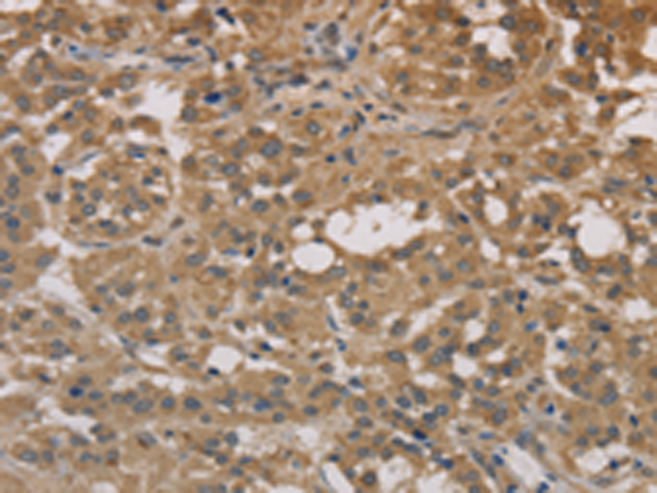 Rabbit Polyclonal Antibody to DEGS1