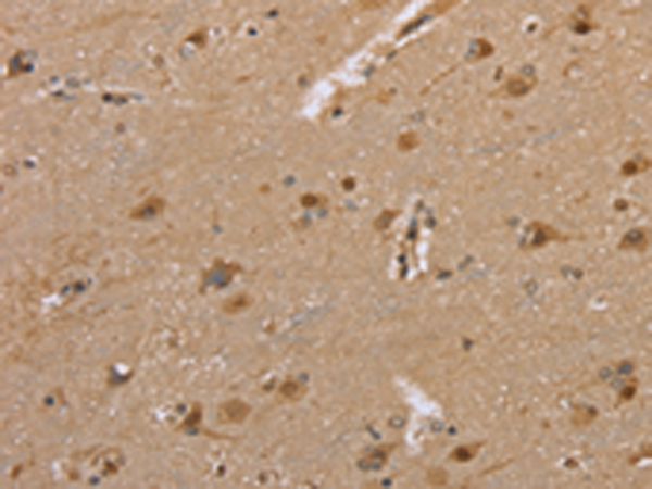 Rabbit Polyclonal Antibody to DLD