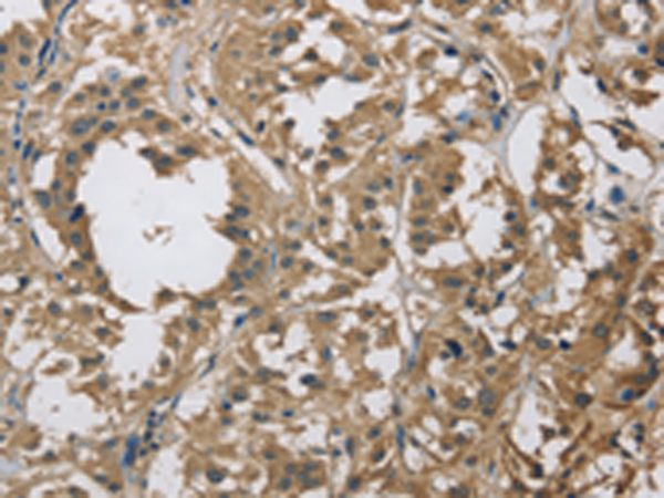 Rabbit Polyclonal Antibody to DSG2