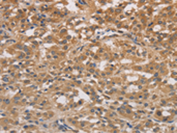 Rabbit Polyclonal Antibody to DSTN
