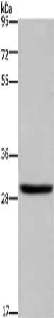 Rabbit Polyclonal Antibody to DHRS3