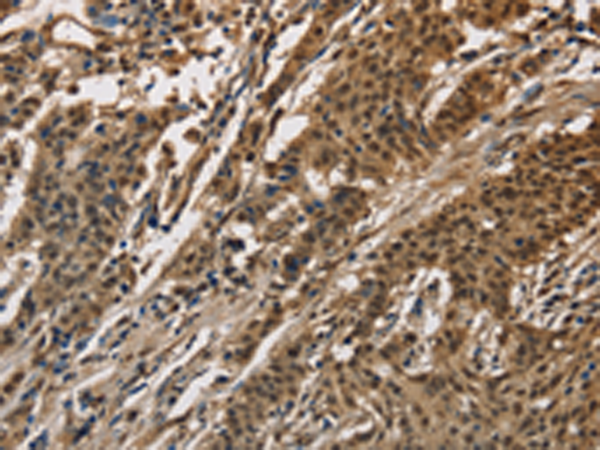 Rabbit Polyclonal Antibody to CCAR1
