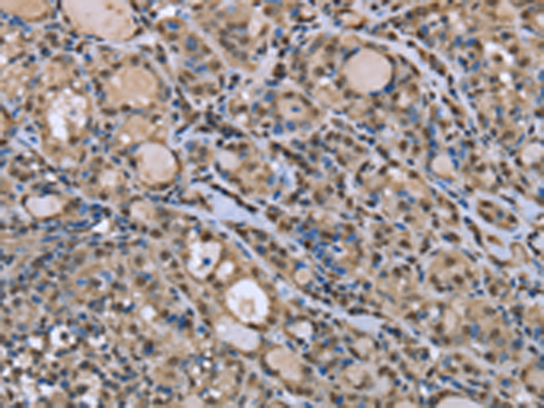 Rabbit Polyclonal Antibody to DYNLL1