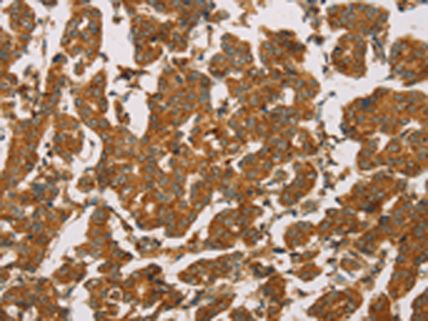 Rabbit Polyclonal Antibody to DLL4